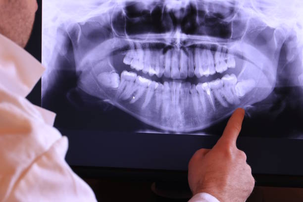 Best Same-Day Emergency Dental Services in Fulshear, TX
