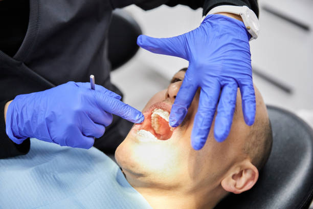 Best Emergency Dental Care for Broken or Chipped Teeth in Fulshear, TX