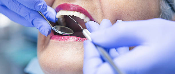 Best Emergency Dental Care for Broken or Chipped Teeth in Fulshear, TX